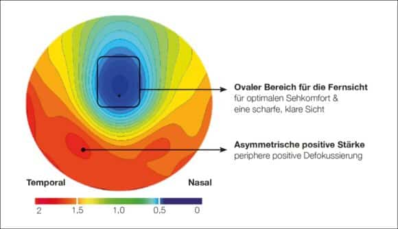 Wetzlich Myopie-Brillenglas nomy Design 1